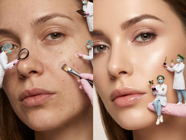 Surreal Skincare Before/After Editorial with Miniature Figures